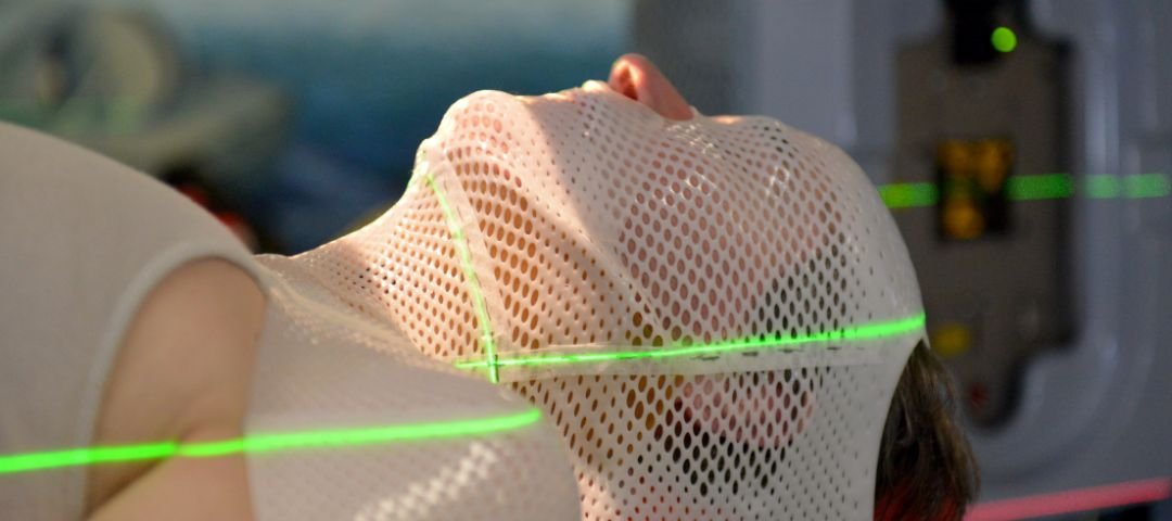 Radioterapia: qué es realmente, cómo funciona y qué esperar de tu tratamiento